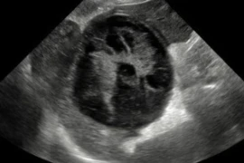 US image.webp