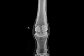D_26_10_13_Lahmheitsquelle_Fessel_Differenzialdiagnosen_im_Check_Titelbild_300x200.png