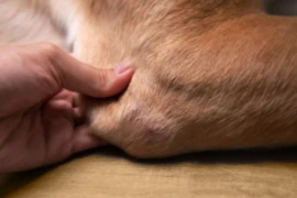 E_26_03_10_ Humeral Condylar Fractures_300x200.png